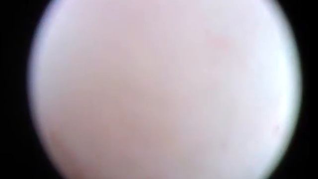 цистоскопия, камни в мочевом пузыре Ветеринарная клиника "Ветдоктор" Воронеж. смотреть онлайн