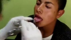 PERFORACIÓN LENGUA / PIERCING BANANA