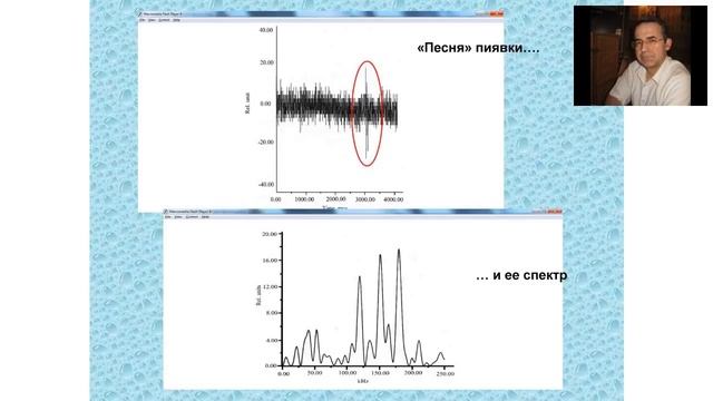 Гирудотерапия. Вебинар Альберта Ивановича Крашенюка