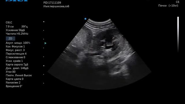 Пиелоэктазия правой почки поперечное сечение у собаки смотреть онлайн