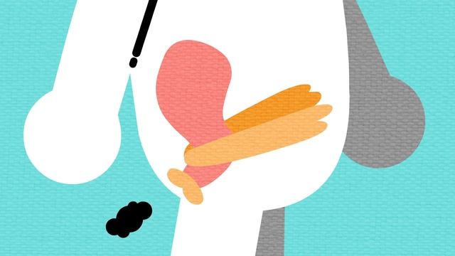 What causes constipation? - Heba Shaheed смотреть онлайн