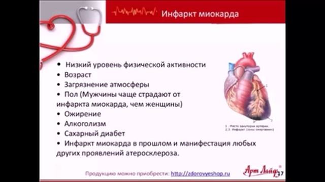 Семинар "Атеросклероз. Ишемическая болезнь сердца. Инфаркт миокарда", Ведущая Побережнюк Т. М.
