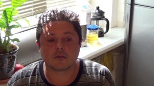 иглоукалывание отзыв