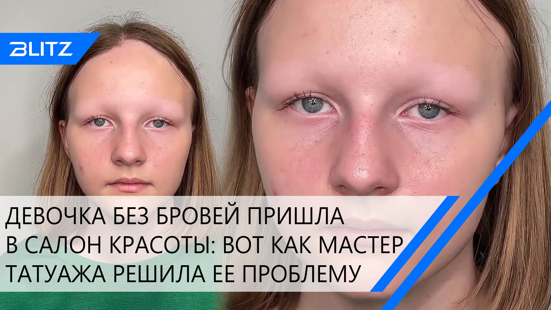 Мастер татуажа сделал перманентный макияж бровей девочке с частичной алопецией