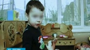 Собака напала на ребёнка укусила за лицо https://forum.doghunter.to/