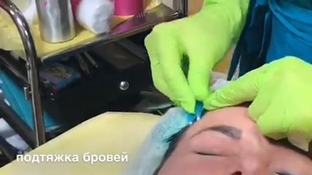 Подтяжка бровей .