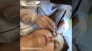 Электроэпиляция на лице