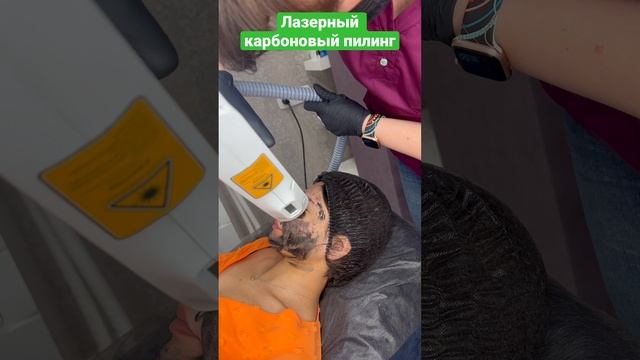 Лазерный карбоновый пилинг #косметолог #косметологмосква #косметология #лазер #карбоновыйпилинг