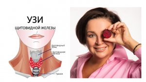 все что ты должен знать о УЗИ щитовидной железы