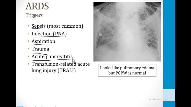 Лёгкие USMLE - 3. Иные темы - 1.Пневмония