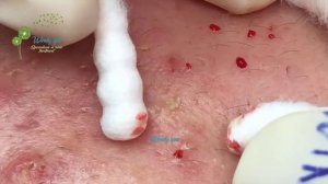 Make Your Day Relaxing with Windy Spa 6#4