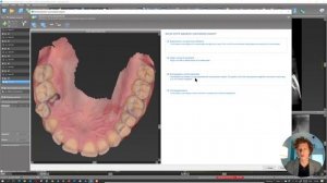 coDiagnostiX аутотрансплантация зуба с помощью ф-ции искусственного интелекта