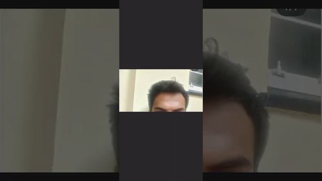 облысение,выпадение волос, андрогенная алопеция,ага,финастерид,миноксидил,трихолог смотреть онлайн