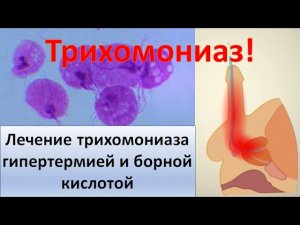 Лечение хронического трихомониаза гипертермией и борной кислотой