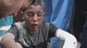 Сотни раненных и десятки погибших. Дети и женщины стали основными жертвами бомбежки в городе Рафах