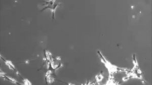 Замедленная съемка нейронов, формирующих новые нейронные связи. Посмотрите, как работает ваш мозг.