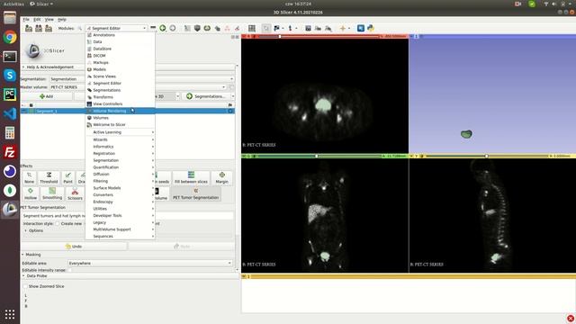 Extracting radiomics features in 3D Slicer tutorial смотреть онлайн