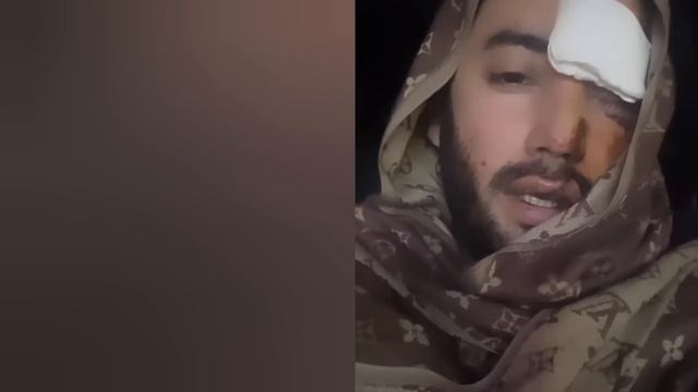 ШОШИЛИНЧ МАШХУР АКТЕР БУГУН