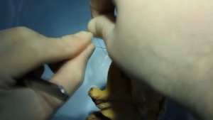 Кишечный анастомоз. Часть I.