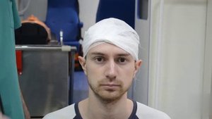 Наложение повязок на волосистую часть головы