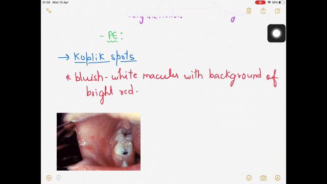 Measles (Rubeola) Virus | Virology смотреть онлайн