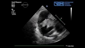 Новообразование правого предсердия (гемангиосаркома) у собаки