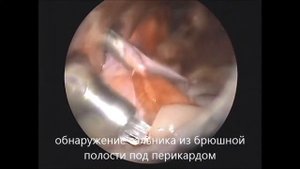 перитонео-перикардиальная грыжа у кошки