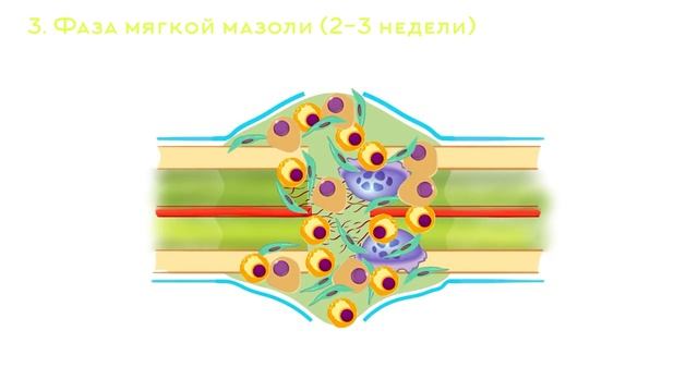 Регенерация костной ткани | Травматология и ортопедия
