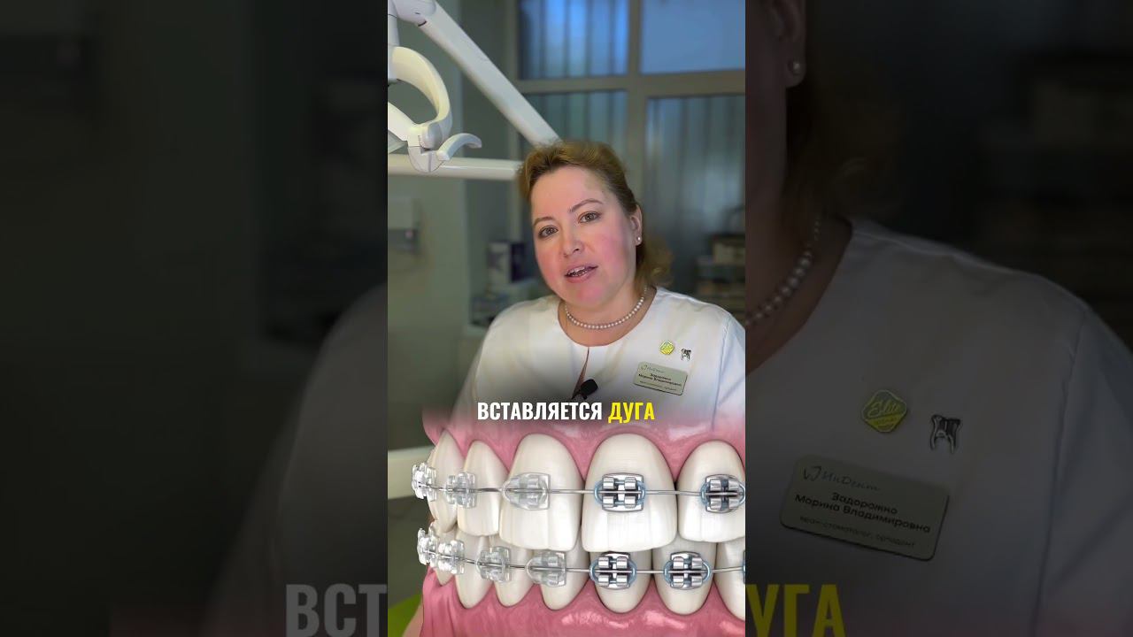 Какие бывают ВИДЫ БРЕКЕТОВ? #брекеты #элайнеры #прикус #исправлениеприкуса #врач #лечениезубов