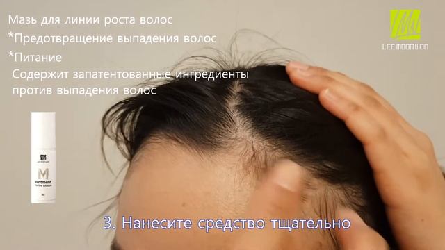 Как восстановить линию роста волос feat. Мазь - М /Опредение очаговой алопеции/lee moon won/이문원 смотреть онлайн