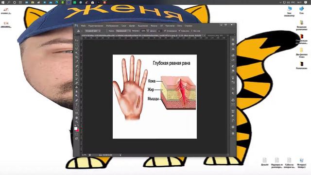 ТЕЛО САМО УМЕЕТ СЕБЯ ЛЕЧИТЬ . смотреть онлайн