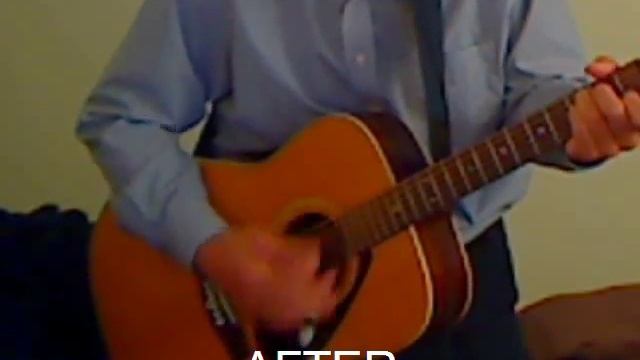 Yamaha FG-335 Before and After JLD Bridge Truss смотреть онлайн