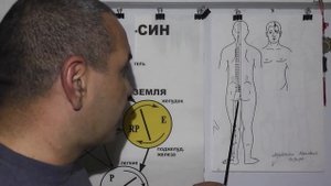 Воспаление Седалищного нерва. Ишиас.