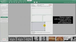 17 Создание собственного шаблона в программе EzDent-i