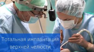 Полная имплантация зубов