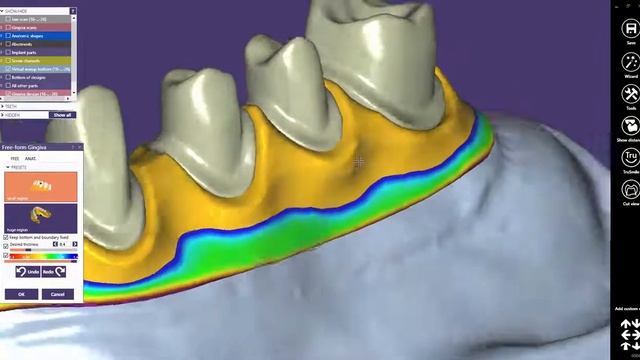 exocad Краткое руководство: использование библиотеки смотреть онлайн