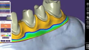 exocad Краткое руководство: использование библиотеки