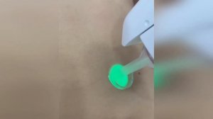 Скидка -20% на лазерную эпиляцию в CosmoDerm Laser Clinic