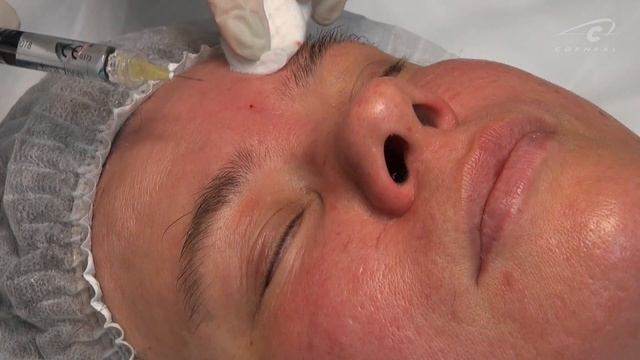 Какую иглу использовать, на какую глубину колоть смотреть онлайн