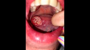 Девушка думала, что просто прикусила язык, но правда оказалась куда страшнее!