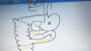 Верхняя брыжеечная аретерия. Анатомия в рисунках