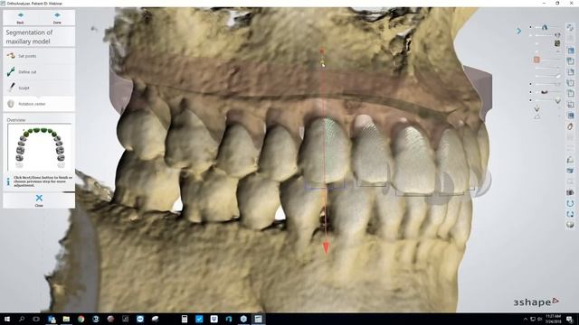 [Webinar] Making Clear Aligners Using the 3Shape Ortho System Module with Brandon Smith, CDT смотреть онлайн