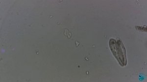 Конъюгация у инфузорий Paramecium.