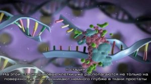 Использование шкалы Глисона при раке предстательной железы