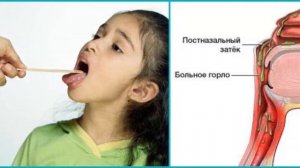 Быстрая чистка ГОРЛА ОТ СЛИЗИ