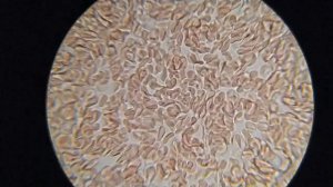 Как ЛУК повлиял на мою кровь