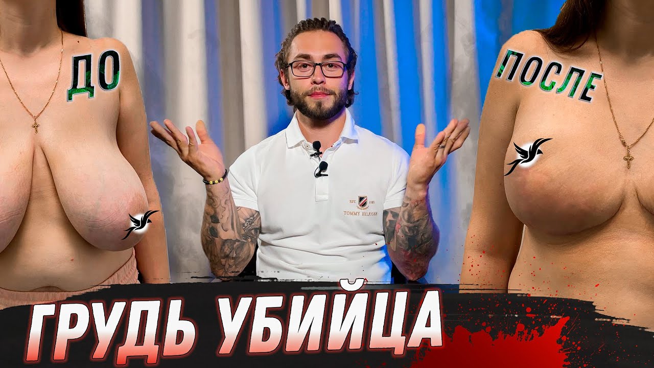 УМЕНЬШЕНИЕ ГРУДИ РЕДУКЦИОННАЯ МАММОПЛАСТИКА
