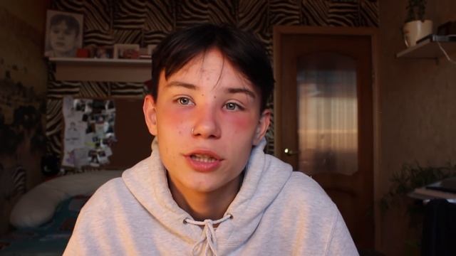 ОПУХОЛЬ ГОЛОВЫ ПОСЛЕ ОКРАШИВАНИЯ // неудачная смена имиджа смотреть онлайн