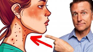 7 неожиданных признаков того, что вы едите СЛИШКОМ много сахара