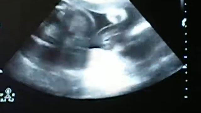 Sebastian Andres Etcheverry Saavedra